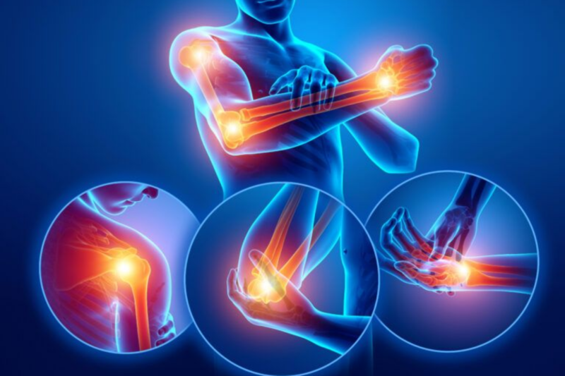 Đau khớp - Verasunshine Glucosamine hỗ trợ tái tạo sụn khớp