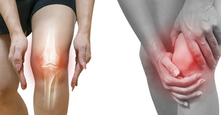 Người cao tuổi bị thoái hóa khớp dùng Verasunshine Glucosamine có tốt không?