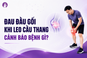 Đau đầu gối khi leo cầu thang cảnh báo bệnh gì?