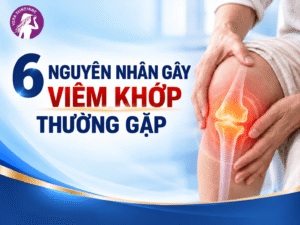 6 nguyên nhân gây viêm khớp thường gặp