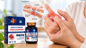 Cách chăm sóc giúp khớp ngón tay linh hoạt hơn